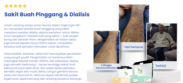 Testi1
