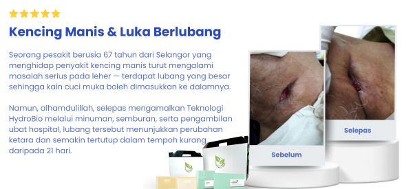 Testi3