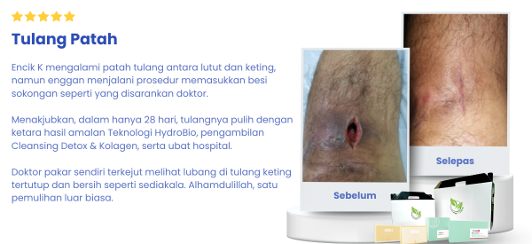 Testi4