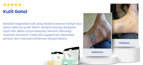 Testi5