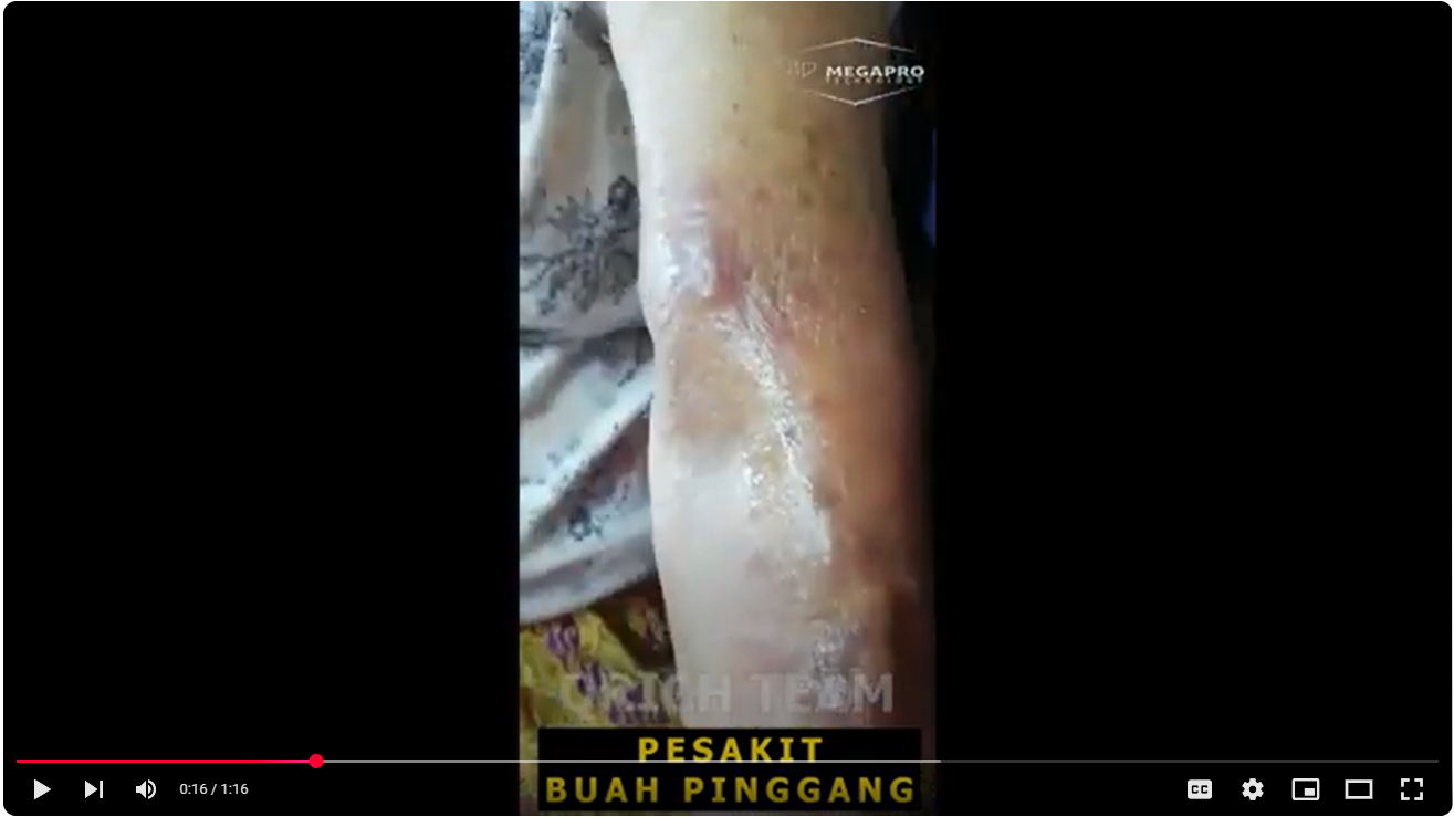 Buah Pinggang